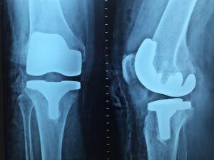 Badania obrazowe – czym są&nbsp;i&nbsp;jaką rolę pełnią w&nbsp;nowoczesnej diagnostyce?