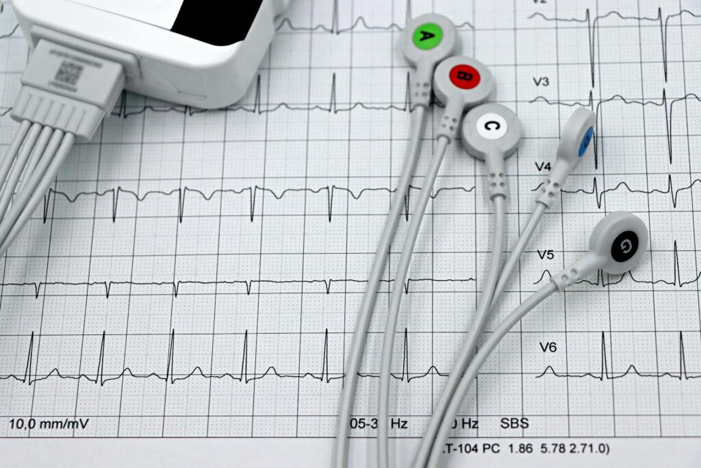 Czy infekcja może nasilać arytmie – mechanizmy i znaczenie kliniczne informacje